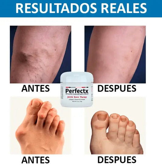 Terapia articular y muscular Perfectx™