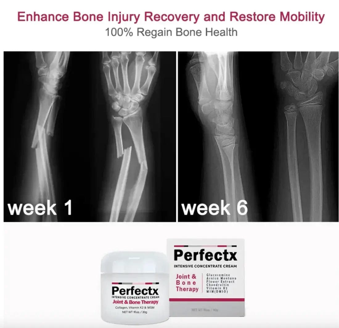 Terapia articular y muscular Perfectx™