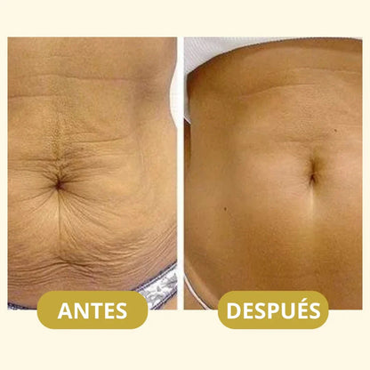 Aceite Original Body Magic™