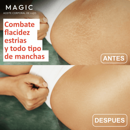 Aceite Original Body Magic™
