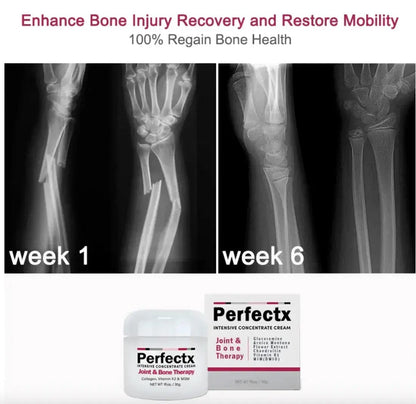 Terapia articular y muscular Perfectx™